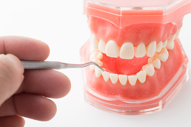 入れ歯治療とは？