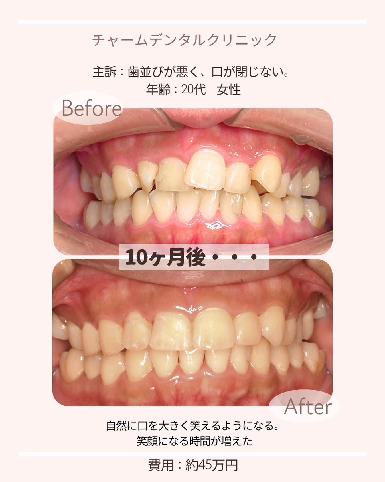 下北沢チャームデンタルクリニックです♩
